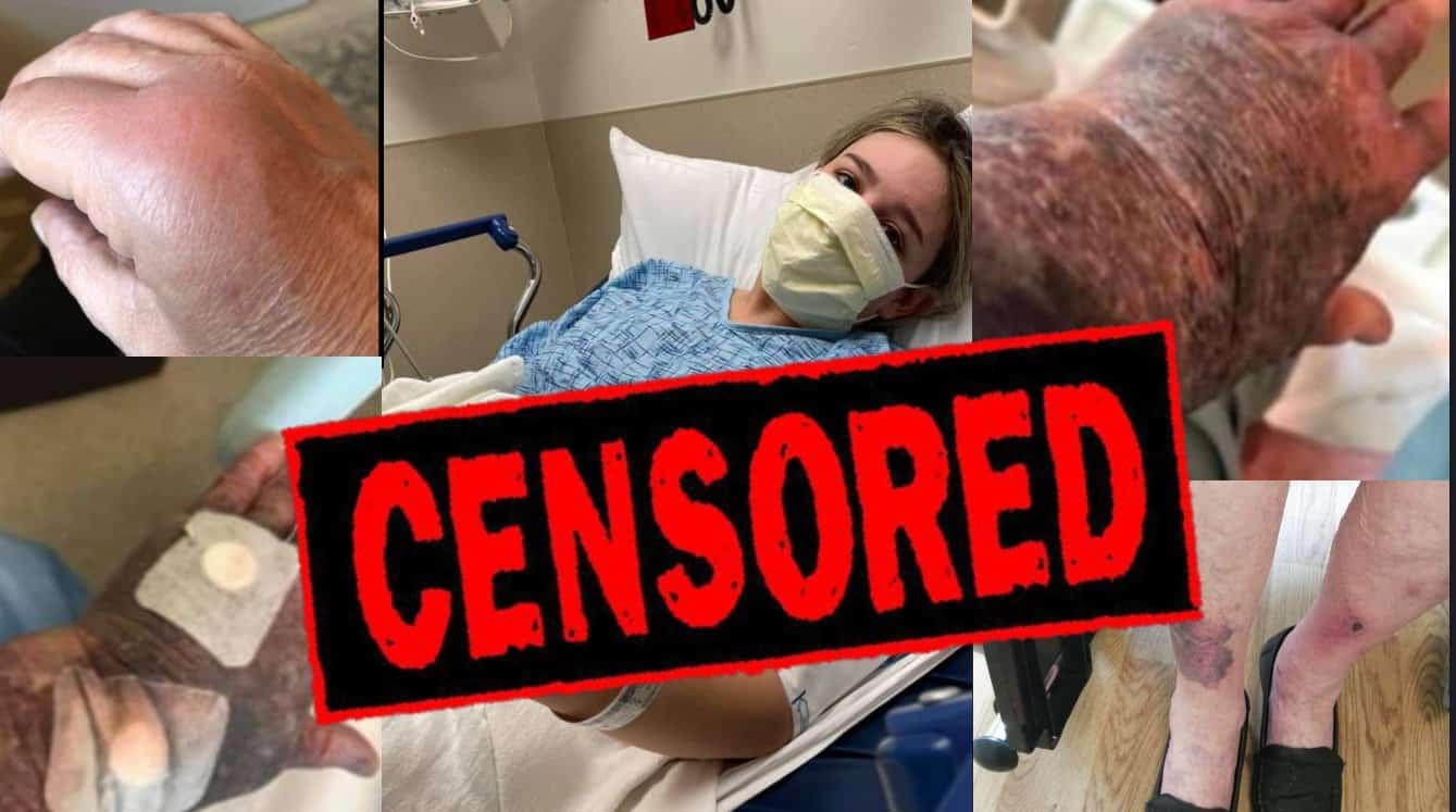 Censored COVID Vaccine Victims Demand Answers In Private
Facebook Group 1